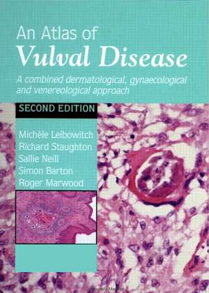 An Atlas of Vulval Diseases: A Combined Dermatological, Gynaecological and Venereological Approach de Michèle Leibowitch