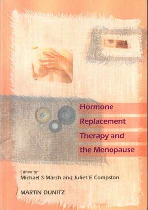 Hormone Replacement Therapy and the Menopause de Juliet E. Dr Compston