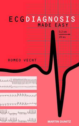 ECG Diagnosis Made Easy de Romeo J. Vecht