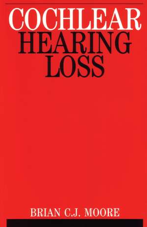 Cochlear Hearing Loss de Brian C. J. Moore