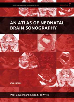 An Atlas of Neonatal Brain Sonography – Clinics in Developmental Medicine de P Govaert