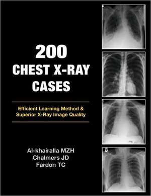 200 Chest X-Ray Cases de Mudher Al-Khairalla