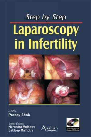 Step by Step Laparoscopy in Infertility de Pranay Shah