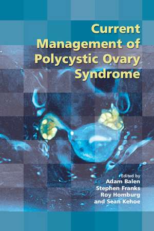 Current Management of Polycystic Ovary Syndrome de Adam Balen