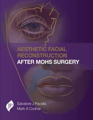 Aesthetic Facial Reconstruction After Mohs Surgery de Salvatore Pacella