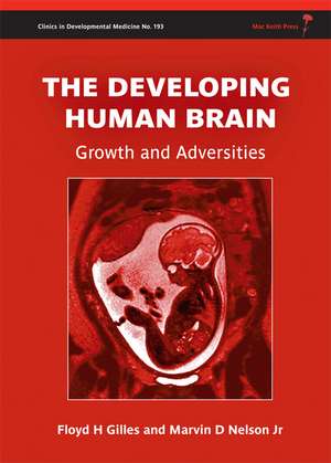 The Developing Human Brain: Growth and Adversities de Floyd Harry Gilles