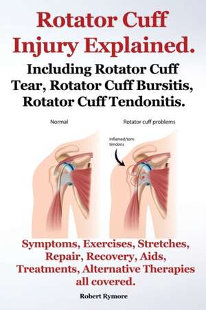 Rotator Cuff Injury Explained. Including Rotator Cuff Tear, Rotator Cuff Bursitis, Rotator Cuff Tendonitis. Symptoms, Exercises, Stretches, Repair, Re de Robert Rymore