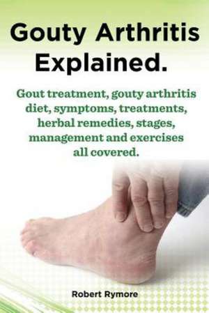 Gouty Arthritis Explained. Gout Treatment, Gouty Arthritis Diet, Symptoms, Treatments, Herbal Remedies, Stages, Management and Exercises All Covered.: Datos E Informacion.Cuidado, Cria, Jaulas, Ser Propietario, Casa, Hogares, Alimento, Alime de Robert Rymore