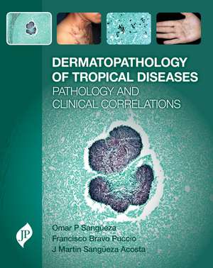 Dermatopathology of Tropical Diseases de Omar Sangueza