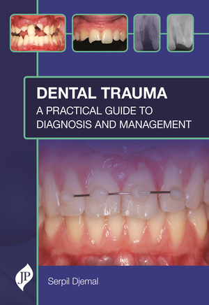 Dental Trauma: A Practical Guide to Diagnosis and Management de Serpil Djemal