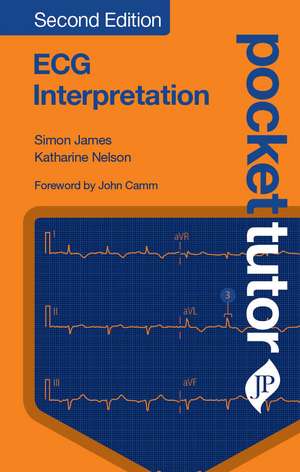 Pocket Tutor ECG Interpretation de Simon James