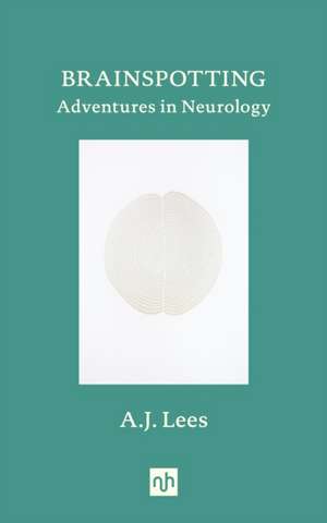 Brainspotting de A. J. Lees