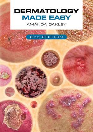 Dermatology Made Easy, second edition de Amanda Oakley