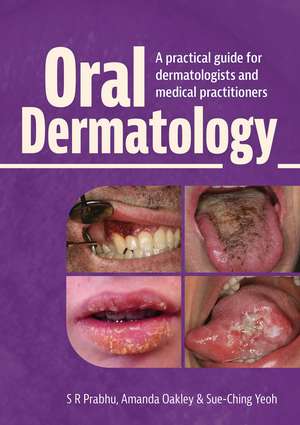 Oral Dermatology de S R Prabhu