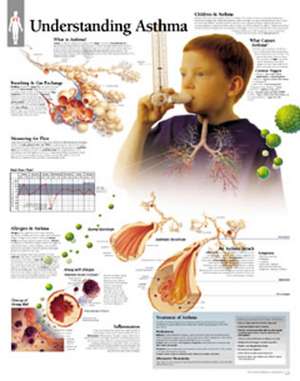 Understanding Asthma Chart: Wall Chart de Scientific Publishing