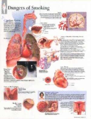 Poster: Efectele fumatului: Effects of Smoking Chart: Wall Chart de Scientific Publishing