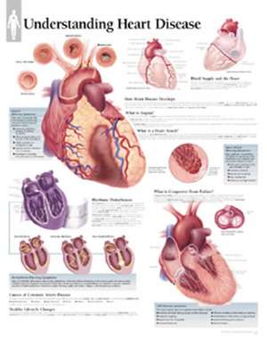 Understanding Heart Disease Chart: Wall Chart de Scientific Publishing