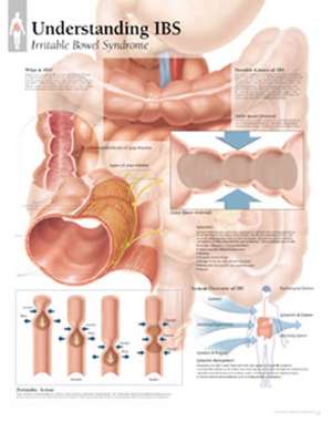 Understanding Ibs Chart: Laminated Wall Chart de Scientific Publishing