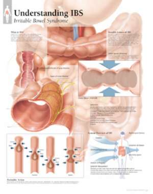 Understanding IBS Laminated Poster de Scientific Publishing