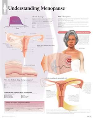 Understanding Menopause Chart: Laminated Wall Chart de Scientific Publishing