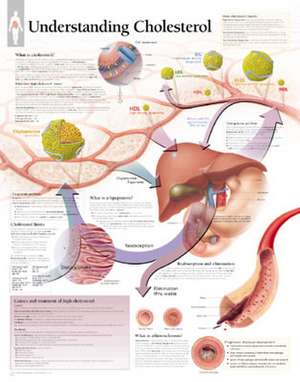 Understanding Cholesterol Chart: Laminated Wall Chart de Scientific Publishing