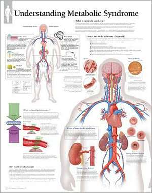 Metabolic Syndrome Chart: Laminated Wall Chart de various