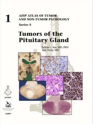 Tumors of the Pituitary Gland de Arie Perry