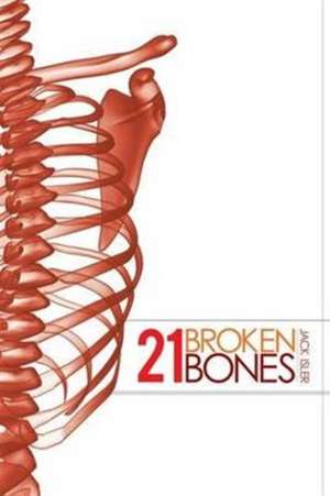 21 Broken Bones de MD Jack Isler