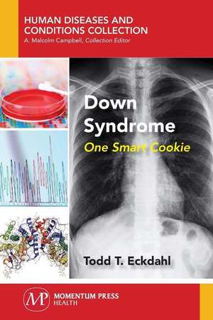 Down Syndrome de Todd T. Eckdahl