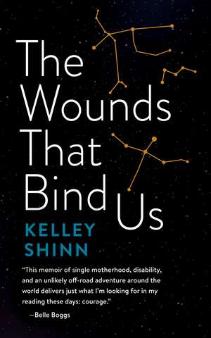 The Wounds That Bind Us de Kelley Shinn