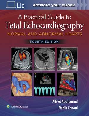 A Practical Guide to Fetal Echocardiography: Normal and Abnormal Hearts de Alfred Z. Abuhamad MD