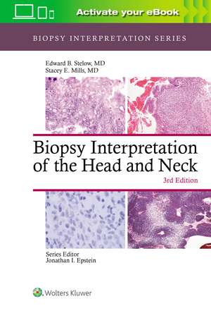 Biopsy Interpretation of the Head and Neck de Edward B. Stelow MD