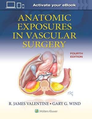 Anatomic Exposures in Vascular Surgery de R. James Valentine MD, FACS