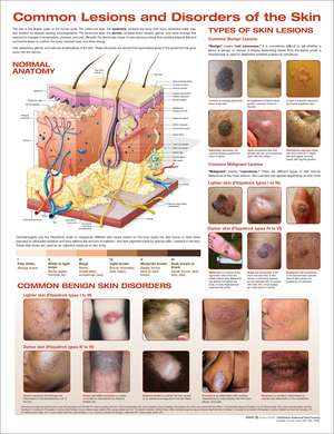 Common Lesions and Disorders of the Skin Anatomical Chart de Anatomical Chart Company