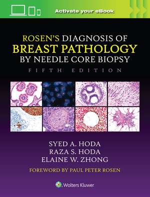 Rosen's Diagnosis of Breast Pathology by Needle Core Biopsy de Syed A. Hoda MD