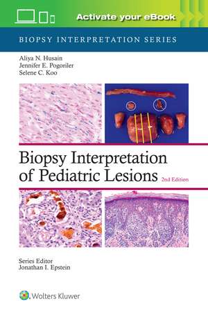 Biopsy Interpretation of Pediatric Lesions: Print + eBook with Multimedia de ALIYA NOOR HUSAIN M.D.