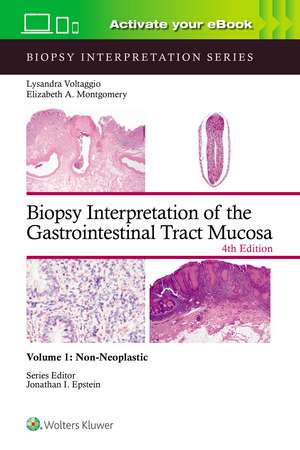 Biopsy Interpretation of the Gastrointestinal Tract Mucosa Volume 1: Non-Neoplastic: Print + eBook with Multimedia de LYSANDRA VOLTAGGIO