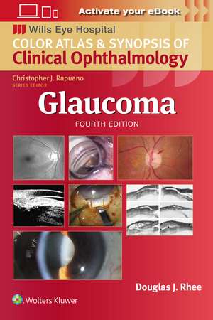 Glaucoma de Douglas J. Rhee MD