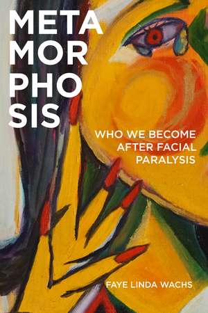 Metamorphosis: Who We Become after Facial Paralysis de Faye Linda Wachs