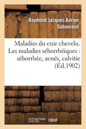 Maladies Du Cuir Chevelu. Les Maladies Seborrheiques