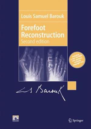 Forefoot Reconstruction de Louis-Samuel Barouk