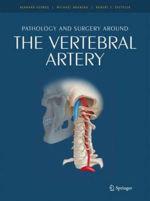 Pathology and surgery around the vertebral artery de Bernard George