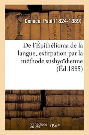 de l'Épithélioma de la Langue, Extirpation Par La Méthode Sushyoïdienne de Denuce-P