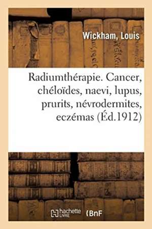 Radiumthérapie. Cancer, Chéloïdes, Naevi, Lupus, Prurits, Névrodermites, Eczémas de Edwards Ragon