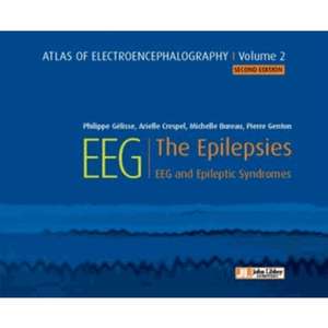 Atlas of Electroencephalography – Volume 2 Atlas