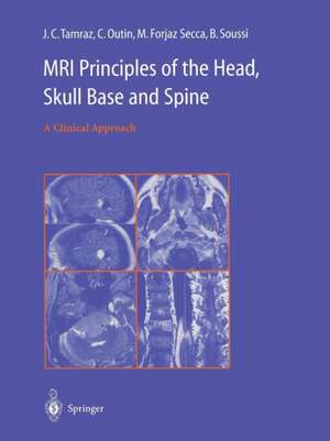 MRI Principles of the Head, Skull Base and Spine: A Clinical Approach de J.C. Tamraz