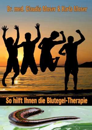 So hilft ihnen die Blutegeltherapie de Claudia Moser