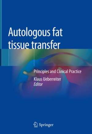 Autologous fat tissue transfer: Principles and Clinical Practice de Klaus Ueberreiter