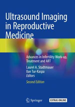 Ultrasound Imaging in Reproductive Medicine: Advances in Infertility Work-up, Treatment and ART de Laurel A. Stadtmauer