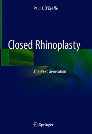 Closed Rhinoplasty: The Next Generation de Paul J O'Keeffe